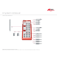 Implant Retrieval Kit Wall Chart