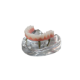 Show Model All-on-4 with NobelActive Implants